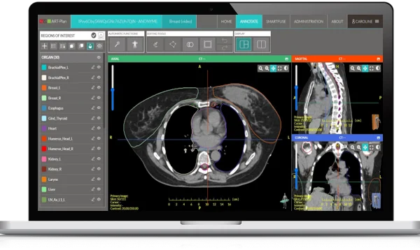 AI-based Radiotherapy Solutions – ART Plan by TheraPanacea